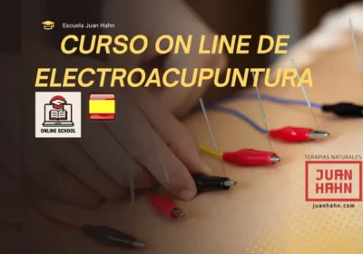 Electroacupuntura — Juan Hahn